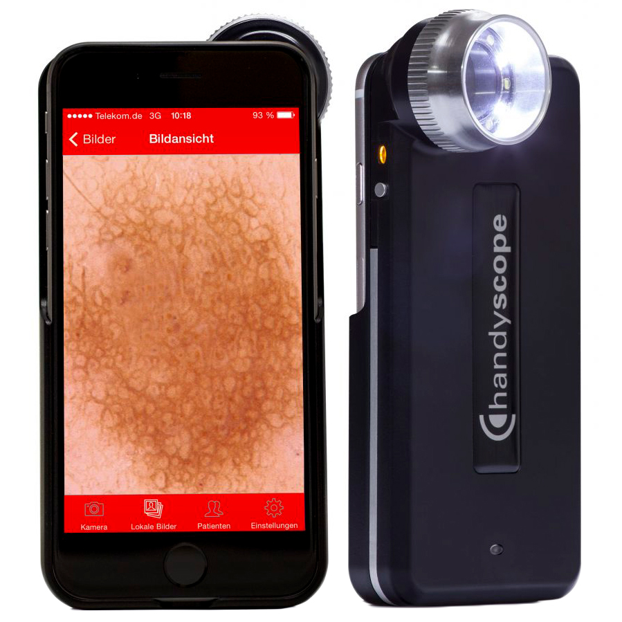 FotoFinder Handyscope Дерматоскоп купить в Москве – Цена оборудования с  доставкой